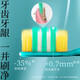 Huibaishi quadruple hair transplantation deep cleaning between teeth adult toothbrush soft bristles unisex fresh mouth 1 piece random color