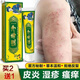 Shiduqing ointment anti-pruritic ointment for skin itching, dermatitis, red rash, small red pimples, systemic neurogenic dry eczema, a box