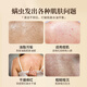 Lishikang sulfur mites and shower gel liquid soap removes mites and acne on the front and back of the chest and back to control oil and relieve itching.