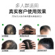 Sumei's (COMOOS) hair fiber powder to modify and style wig powder fiber hair replacement artifact to fill bald hair fluffy powder hairdressing wig powder 25g dark brown