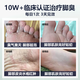BEAI Potassium Permanganate Solution Foot Bubble Foot Special Antibacterial and Infectious Foot Washing Solution Foot Soaking Medicinal Pack to Remove Sweat and Foot Odor