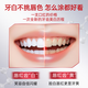 高露洁（Colgate）牙齿美白精华笔 液体牙贴 涂抹式亮白去黄去牙渍 美白精华笔2.5ml 1支
