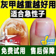 Nanjing Tongrentang onychomycosis special antibacterial liquid onychomycosis set 35g
