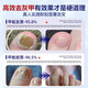 Nanjing Tongrentang onychomycosis special antibacterial liquid onychomycosis set 35g