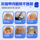 Nanjing Tongrentang onychomycosis special antibacterial liquid onychomycosis set 35g