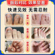 Special effects on onychomycosis. Nail thickening, yellowing, thickening and emptying. Fungal infection. Imported from Japan. Buy 2 shots of 3. 99w. The patient is fully cured. Recommended by doctors. What medicine is good for onychomycosis in Jingdong store? Quick onychomycosis special large ointment room