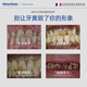 Mannosen Whitening Teeth Patches Whitening Teeth Yellow Teeth Stains Smoke Stains Remove Yellow Stains Remove Bad Breath Temperature and No Acid Teeth Portable [7 Days of Temperature Brightening] 14 Patches/Box