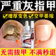 Nanjing Tongrentang onychomycosis special antibacterial liquid onychomycosis set 35g