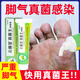 VKR Powerful Fungus King Athlete's Foot Cream Fungus Infected Feet Peeling, Erosion, Blisters, Sore Feet, Sweaty Feet, Odorful Feet Itching. Buy 2 shots and 3 boxes to eradicate the roots. Only spend 2 boxes.