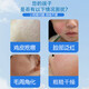 ADPWY children's skin removal artifact for small particles and pimples on children's face, special for keratosis pilaris, can be used with ointment for teenagers