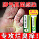 VKR Powerful Fungus King Athlete's Foot Cream Fungus Infected Feet Peeling, Erosion, Blisters, Sore Feet, Sweaty Feet, Odorful Feet Itching. Buy 2 shots and 3 boxes to eradicate the roots. Only spend 2 boxes.