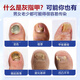 Dr. Xin's Onychomycosis Specially Used for Severe Nail Infections to Remove Onychomycosis, Yellowing and Thickening Liquid Root Cream 30ml