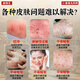Hong Kong Pharmacy Co., Ltd. Itch-breaking King, Itch-Relieving King, Antibacterial Skin, Anal Itching, Moisturizing Scrotum, Body Itching Wolfsbane Ointment, Rash Roots for the Elderly