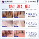 Jilinli Pharmaceutical Japanese athlete's foot spray cream set peeling hands and feet, rotten feet, itchy feet, smelly feet, foot blisters, erosion, skin itching