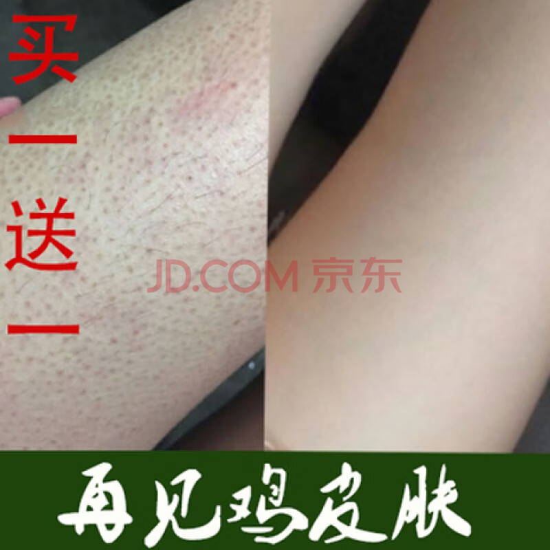 改善脖子鸡皮肤消除(脖子鸡皮肤怎么消除最有效) 改善脖子鸡皮肤消除(脖子鸡皮肤怎么消除最有效)