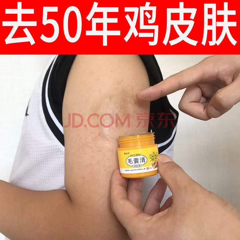 鸡皮肤上有虫子(鸡皮肤上的寄生虫) 鸡皮肤上有虫子(鸡皮肤上的寄生虫)