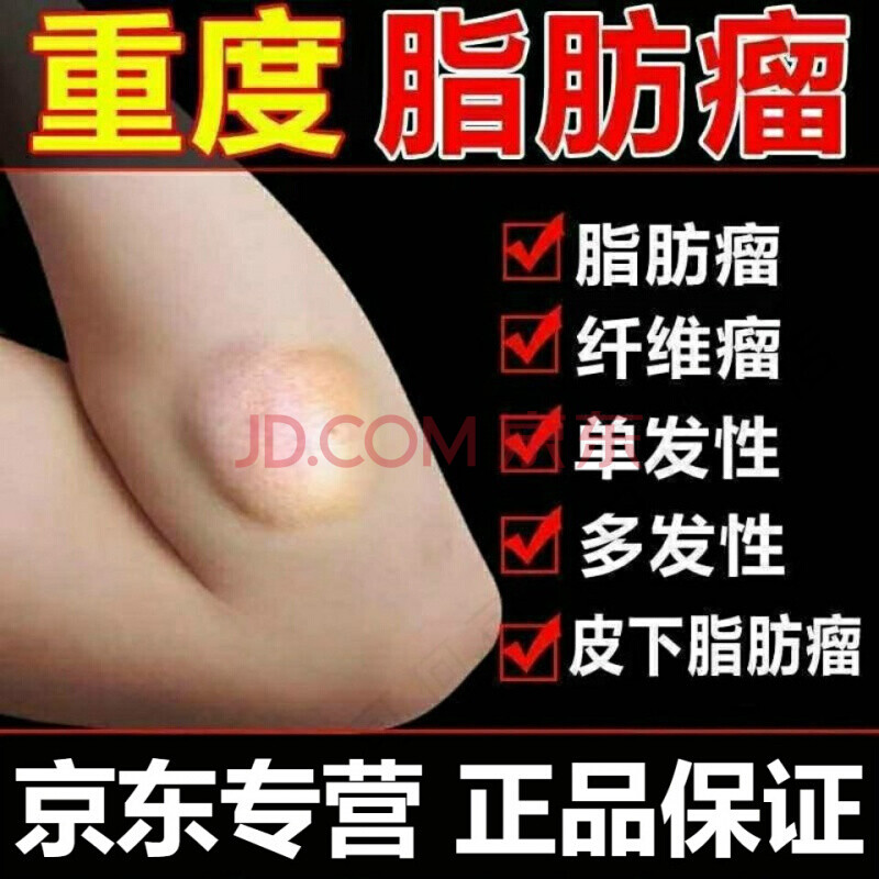 脂肪瘤去除膏 成人进口皮下脂肪瘤 脂肪瘤贴 脂肪瘤消瘤膏专消36种皮