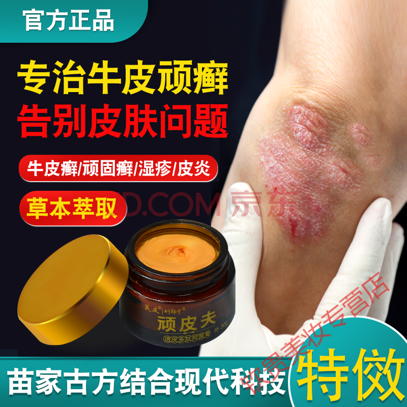 银l屑病牛皮l癣专用顽l皮夫湿l疹皮l炎牛皮l癣头皮l癣体l癣手足l癣止