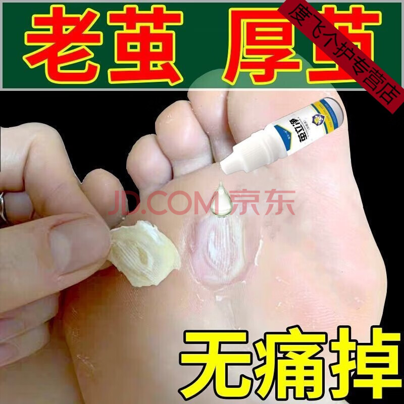 祛i老茧子手脚厚茧皮脚底脚垫死皮鸡i眼膏清关节脚趾老茧茧立净 买3 2