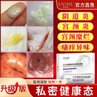 舒奈美卡波姆妇科修复凝胶私处私密保养搭阴道炎宫颈糜烂妇科水润产品用 一盒试用装 可搭小花园 私处保养产品用