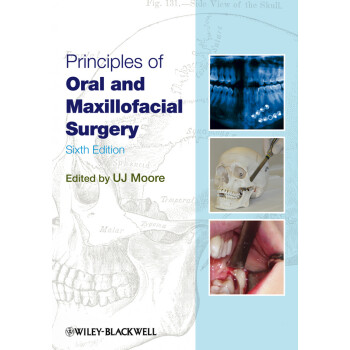 Principles of Oral And Maxillofacial Surgery 6E