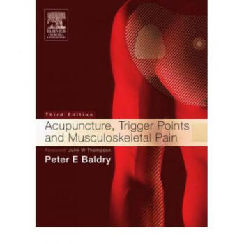Acupuncture, Trigger Points and Musculoskele...
