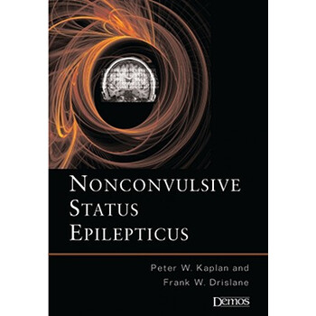 nonconvulsive status epilepticus