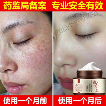 氢醌霜美1白淡化色1斑去斑霜祛点雀斑水分解黑色素