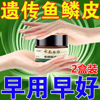 胳膊上的小疙瘩鸡皮肤鱼鳞病皮肤霜蛇皮霜毛囊妙德邦鸡皮干燥粗糙2盒
