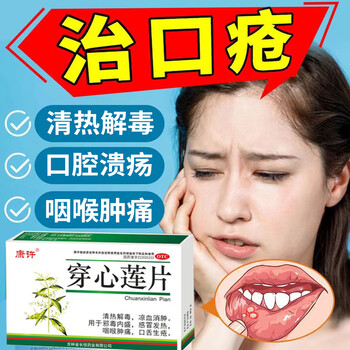口腔溃疡吃什么药 经常口腔溃疡烂嘴口舌生疮口角炎上火舌头烂 清热