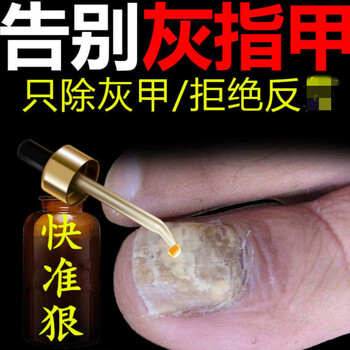 灰指甲特治灰甲王净增厚亮岬沟l炎脱甲软甲脱甲膏修复液专用精油五瓶