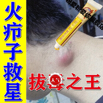 火疖子拔i毒拔脓膏祛屁股坐板疮包肿硬块发l炎箹毛囊去闷头吸脓神i器