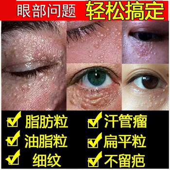 望风舒堂舒颜膏祛脂肪粒去除去油脂粒消除膏眼睛眼部眼角眼霜 图片价格品牌报价 京东