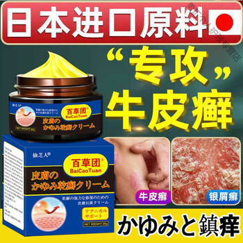 24小时发货牛皮l癣银l屑病特效皮肤偏方瘙痒头皮l癣手足l癣湿l疹荨麻l
