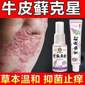 三珍清紫椒癣町酊外用喷剂牛皮1癣藓银1屑病手足1癣1体股1癣头1癣购3