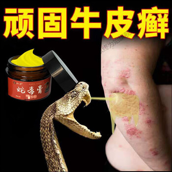 蛇毒膏治牛皮银1屑病专用手足头皮皮肤瘙痒焱湿1疹止痒 一瓶蛇毒膏