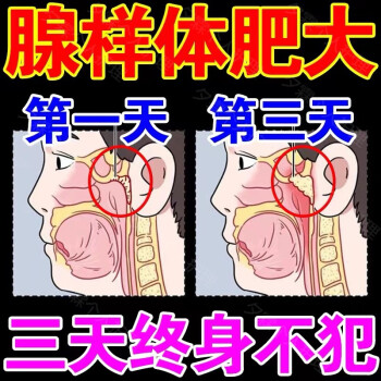 腺樣體肥大貼腺樣體肥大貼面容貼鼻阻塞面部骨骼改變咽吞困難