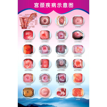 2022新款医院科室挂图女性生殖器解剖图医院宣传画挂图子宫妇科海报