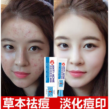 中原宋尔祛痘膏中元中原宋痘痘尔祛痘膏悦芙官网娇西林豆去凝胶修护