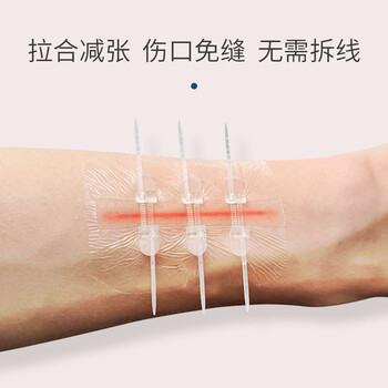 医用免缝针减张器拉链式创口贴免缝胶带皮肤伤口减张贴拉合缝合贴两扣