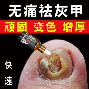 灰甲灵专用去顽固增厚灰甲脱甲软甲膏液增11长液体验装18倍适合轻度灰