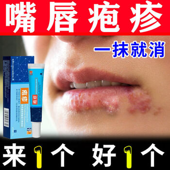 嘴唇起泡唇膏烂嘴角开裂嘴唇干裂脱皮非修复非脓疮口角