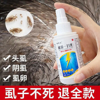 虱立净虱子箹去儿童头虱除成人阴虱百部酊除女孩虱卵一扫光喷雾剂 1瓶