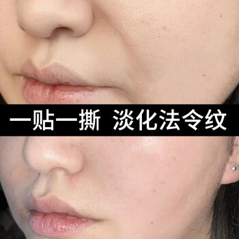 倾姿堂微晶法令纹贴淡化法令纹提拉紧致消除八字嘴角纹胶原蛋白面膜贴