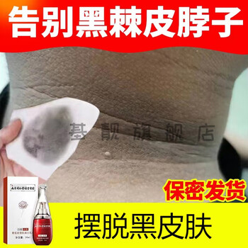 脖子很黑要怎么样去黑,怎么去掉脖子后面的黑杠