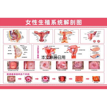 女性生殖器系统解剖图医院宣传画挂图子宫妇科海报宫颈疾病示意图女性