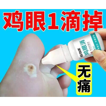 鸡眼膏一滴掉无校褪老茧脚底鸡眼手上鸡眼脚趾鸡尤清严重3瓶装