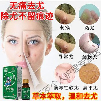 克l疣液丝状尤疣扁平尤疣子瘊肉粒肉痣寻常l疣去除脖子肉粒脚部老茧甲