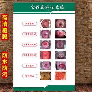 女性生殖图人体内脏解剖系统示意图医学宣传挂图人体结构海报梦倾城yt