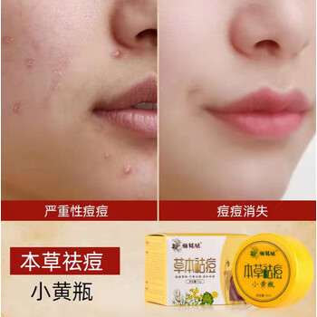 小黄瓶祛痘膏额头脸学生痘霜痘印温和祛痘修复痘肌女男生痘痘疤痘坑